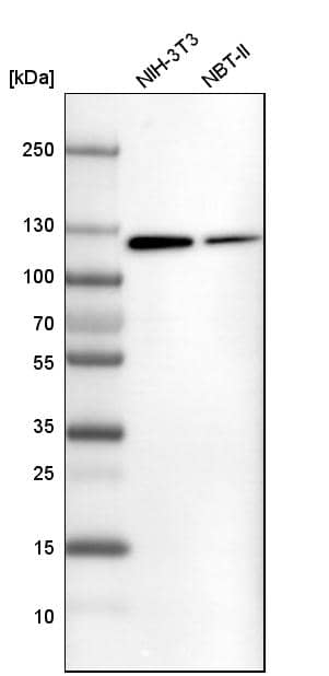ATP Citrate Lyase Antibody - BSA Free Western Blot: ATP Citrate Lyase Antibody - BSA Free [NBP1-90268]