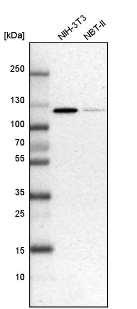 ATP Citrate Lyase Antibody - BSA Free Western Blot: ATP Citrate Lyase Antibody - BSA Free [NBP1-90269]