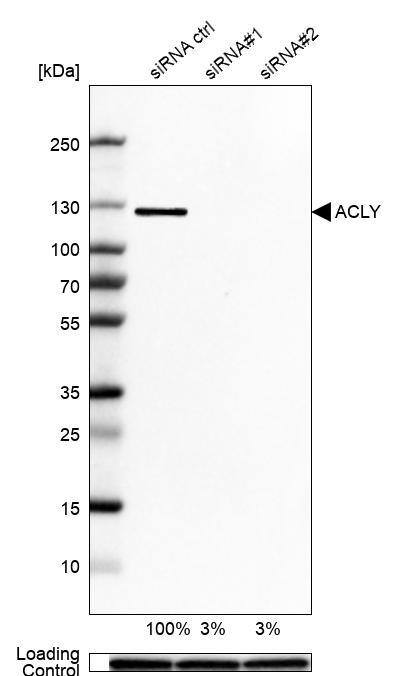ATP Citrate Lyase Antibody - BSA Free Western Blot: ATP Citrate Lyase Antibody - BSA Free [NBP1-90269]