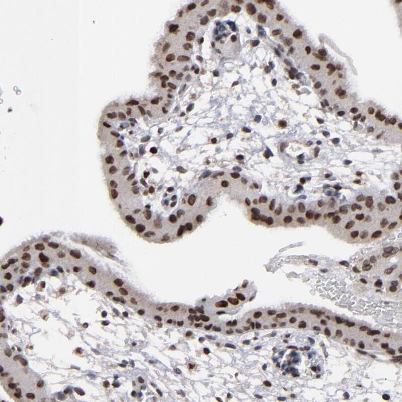 ACF1 Antibody - BSA Free Immunohistochemistry: ACF1 Antibody - BSA Free [NBP1-90270]
