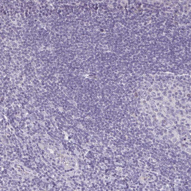 ACF Antibody - BSA Free Immunohistochemistry: ACF Antibody - BSA Free [NBP1-90271]