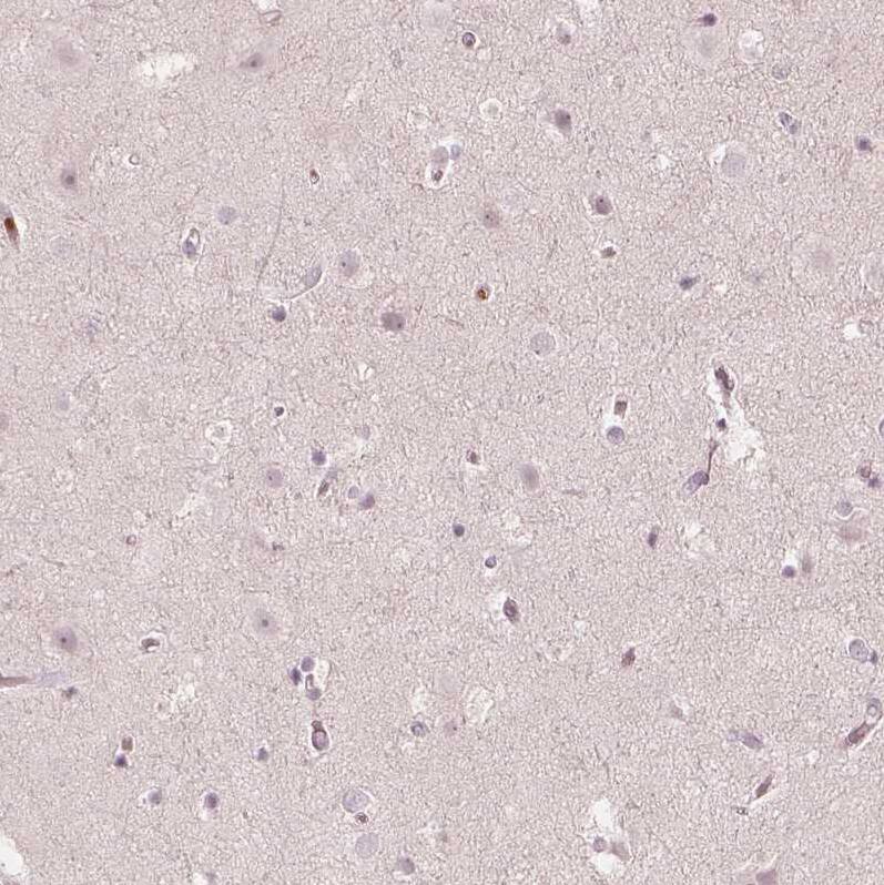 Acetyl Coenzyme A Carboxylase Beta Antibody - BSA Free Immunohistochemistry: Acetyl Coenzyme A Carboxylase Beta Antibody - BSA Free [NBP1-90274]