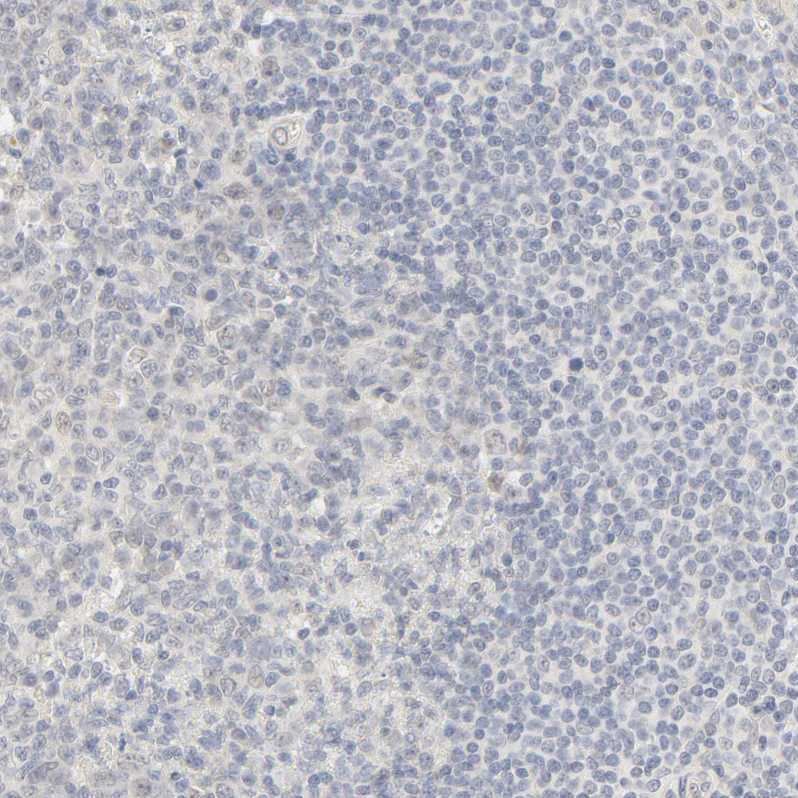 Acetyl CoA synthetase Antibody - BSA Free Immunohistochemistry: Acetyl CoA synthetase Antibody - BSA Free [NBP1-90276]