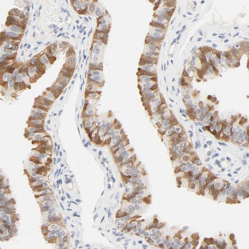 Acetyl CoA synthetase Antibody - BSA Free Immunohistochemistry: Acetyl CoA synthetase Antibody - BSA Free [NBP1-90276]
