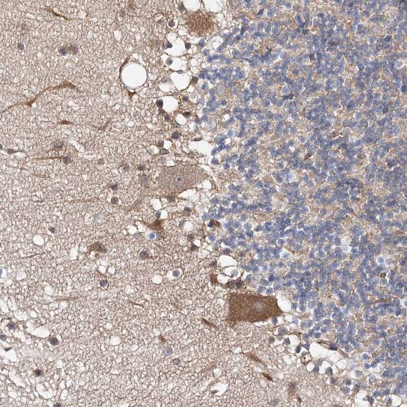 ABRO Antibody - BSA Free Immunohistochemistry: ABRO Antibody - BSA Free [NBP1-90282]