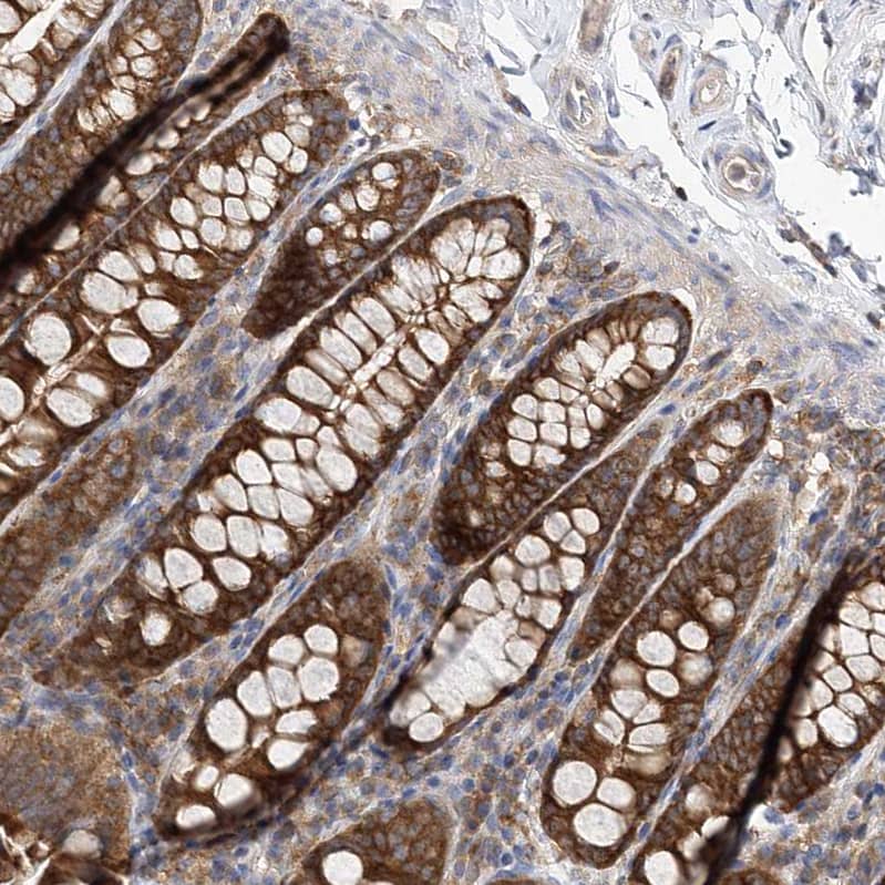 ABRO Antibody - BSA Free Immunohistochemistry: ABRO Antibody - BSA Free [NBP1-90282]