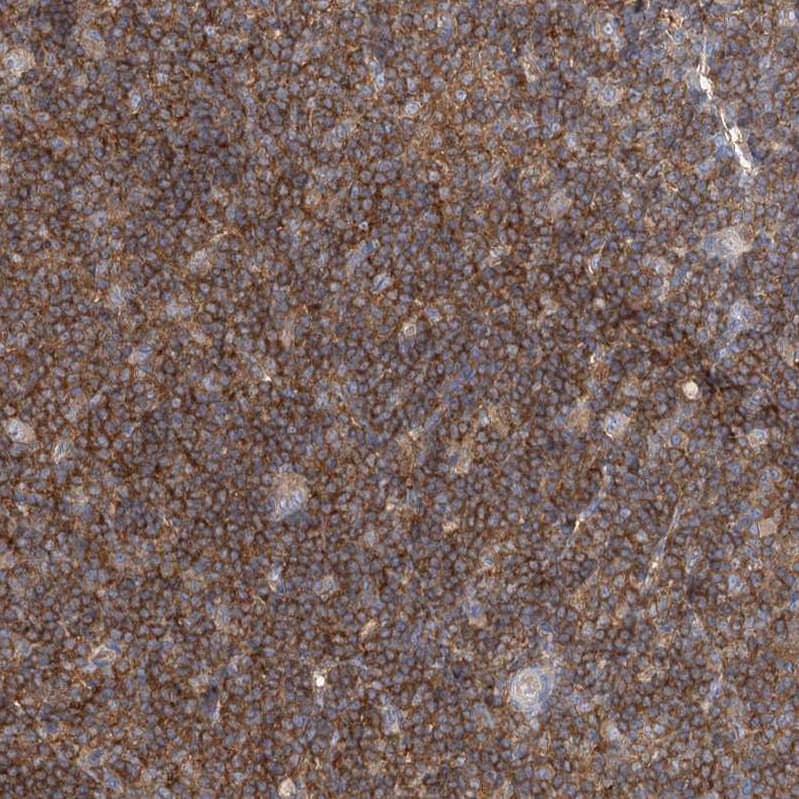 ABRO Antibody - BSA Free Immunohistochemistry: ABRO Antibody - BSA Free [NBP1-90282]