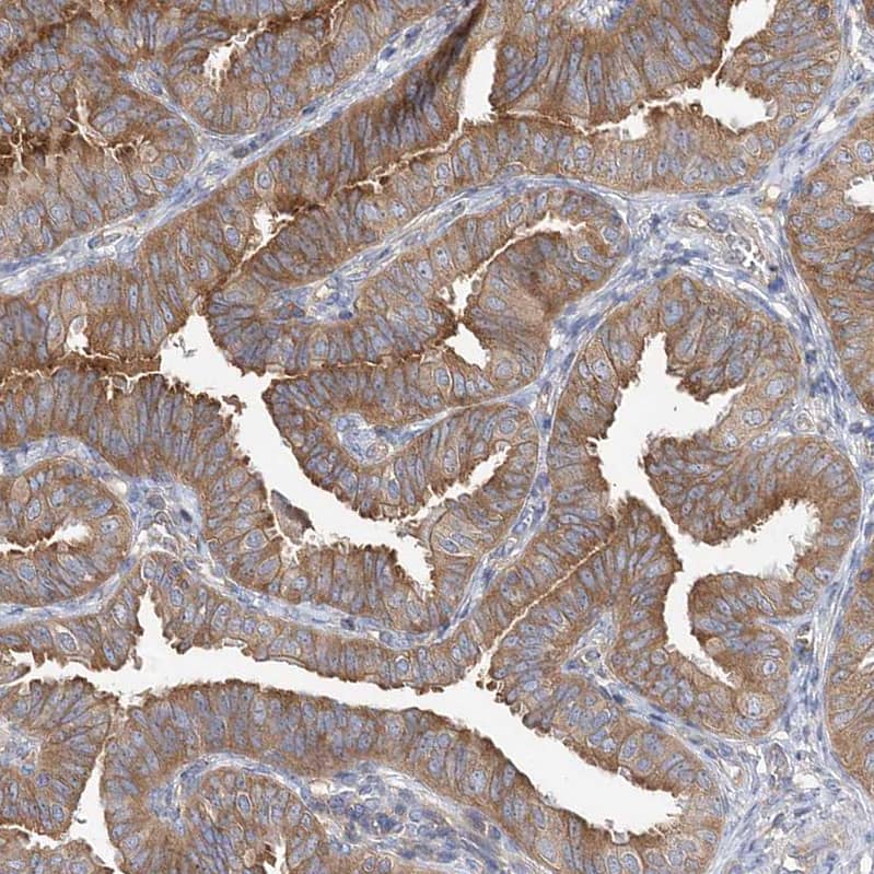 ABRO Antibody - BSA Free Immunohistochemistry: ABRO Antibody - BSA Free [NBP1-90282]