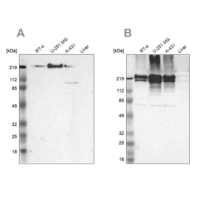 Filamin A Antibody - BSA Free Western Blot: Filamin A Antibody - BSA Free [NBP1-90284]