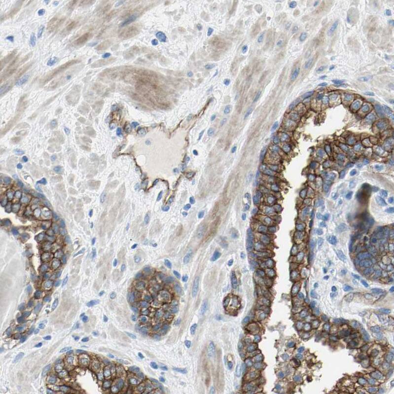 Filamin B Antibody - BSA Free Immunohistochemistry: Filamin B Antibody - BSA Free [NBP1-90285]