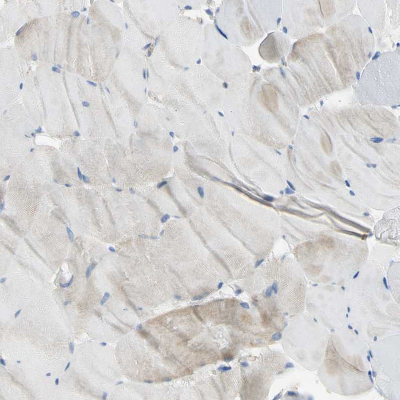 Filamin B Antibody - BSA Free Immunohistochemistry: Filamin B Antibody - BSA Free [NBP1-90285]