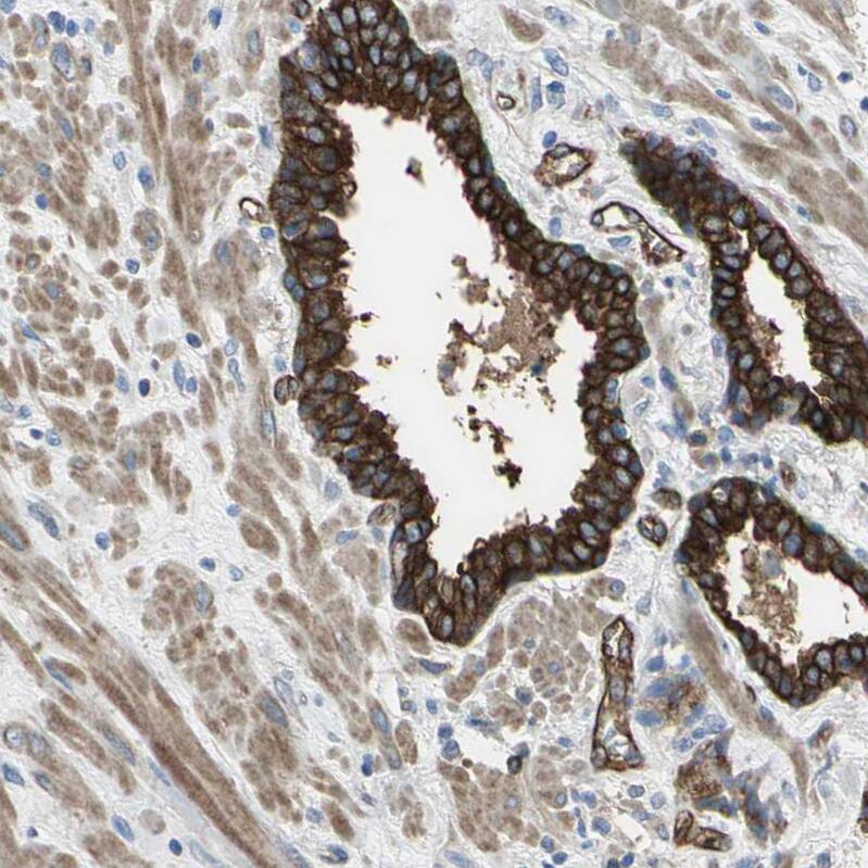Filamin B Antibody - BSA Free Immunohistochemistry: Filamin B Antibody - BSA Free [NBP1-90286]