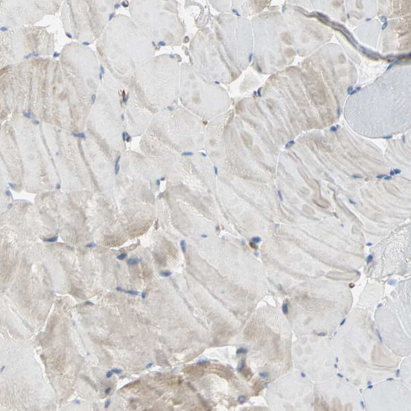 Filamin B Antibody - BSA Free Immunohistochemistry: Filamin B Antibody - BSA Free [NBP1-90286]