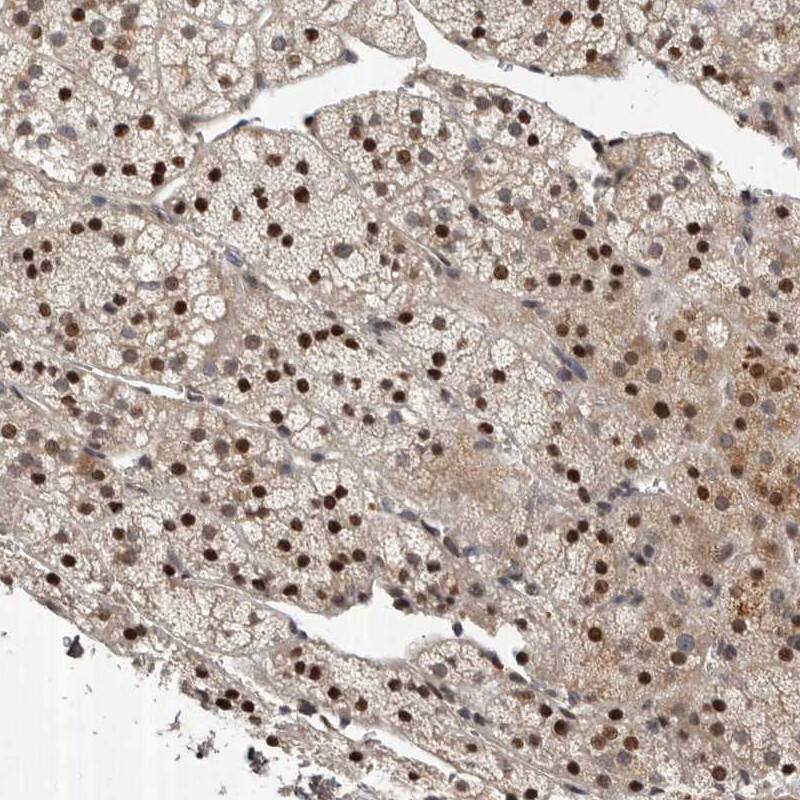 c-Abl Antibody - BSA Free Immunohistochemistry-Paraffin: c-Abl Antibody [NBP1-90289]