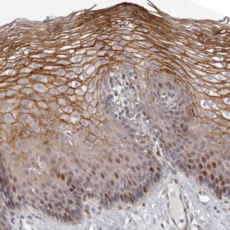 ABHD9 Antibody - BSA Free Immunohistochemistry: ABHD9 Antibody - BSA Free [NBP1-90290]