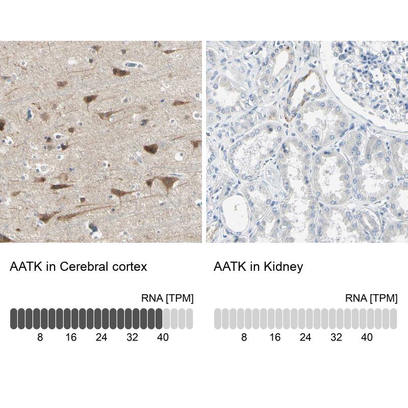 AATK/Serine/threonine-protein kinase LMTK1 Antibody - BSA Free Immunohistochemistry-Paraffin: AATK/Serine/threonine-protein kinase LMTK1 Antibody [NBP1-90292]