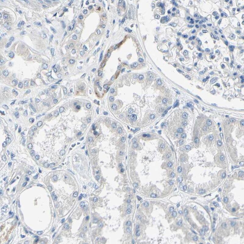 AATK/Serine/threonine-protein kinase LMTK1 Antibody - BSA Free Immunohistochemistry-Paraffin: AATK/Serine/threonine-protein kinase LMTK1 Antibody [NBP1-90292]