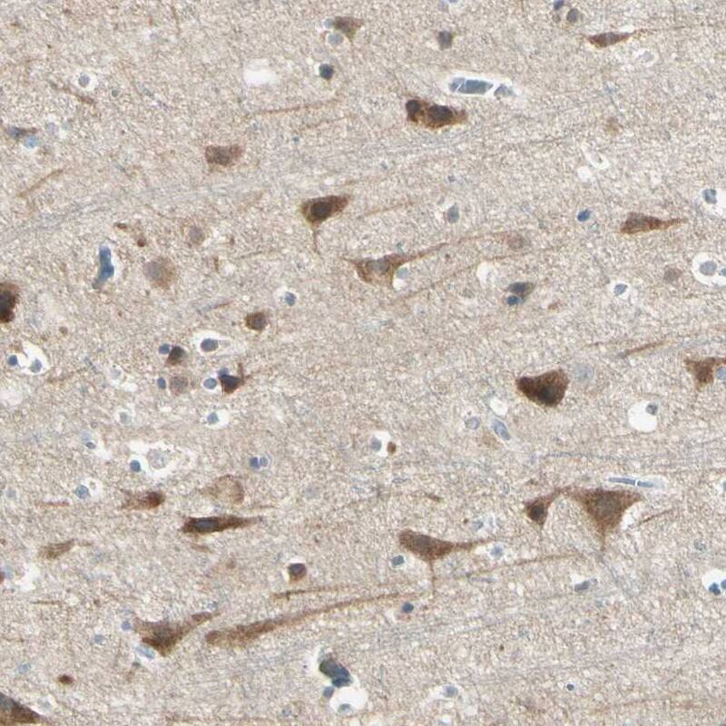 AATK/Serine/threonine-protein kinase LMTK1 Antibody - BSA Free Immunohistochemistry: AATK/Serine/threonine-protein kinase LMTK1 Antibody - BSA Free [NBP1-90292]