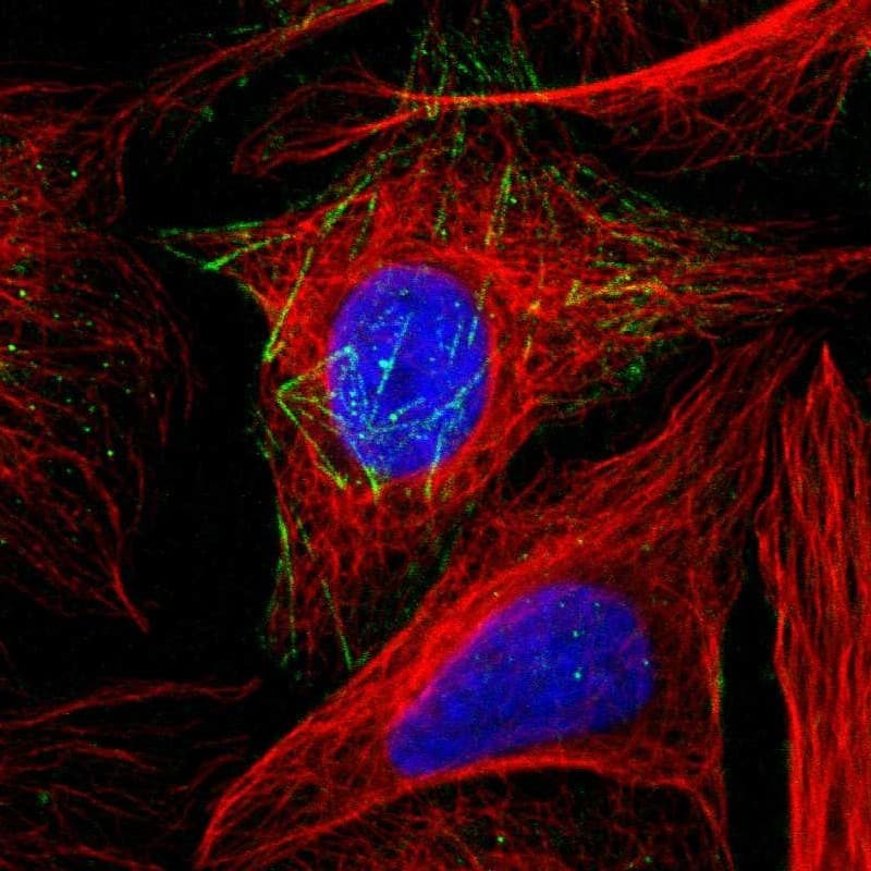 Dopa Decarboxylase/DDC Antibody - BSA Free Immunocytochemistry/ Immunofluorescence: Dopa Decarboxylase/DDC Antibody [NBP1-90293]