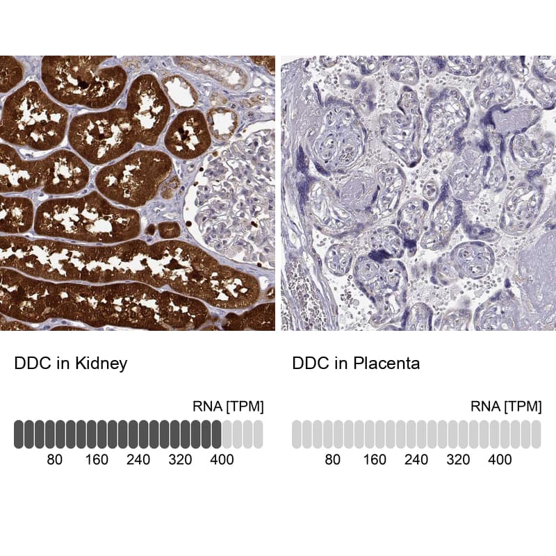Dopa Decarboxylase/DDC Antibody - BSA Free Immunohistochemistry: Dopa Decarboxylase/DDC Antibody - BSA Free [NBP1-90293]