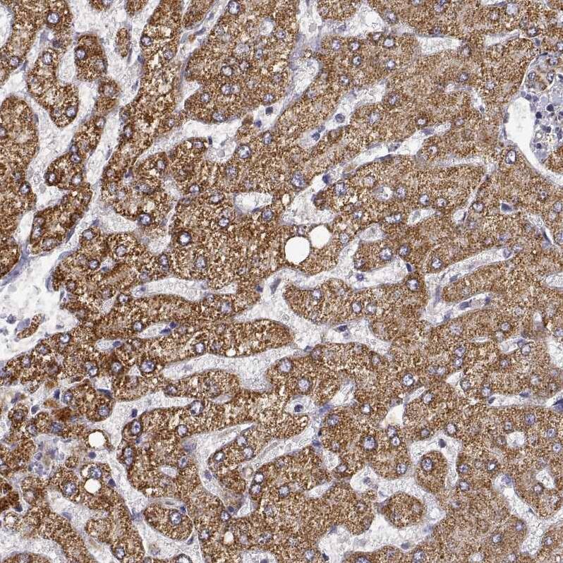 Dopa Decarboxylase/DDC Antibody - BSA Free Immunohistochemistry: Dopa Decarboxylase/DDC Antibody - BSA Free [NBP1-90293]