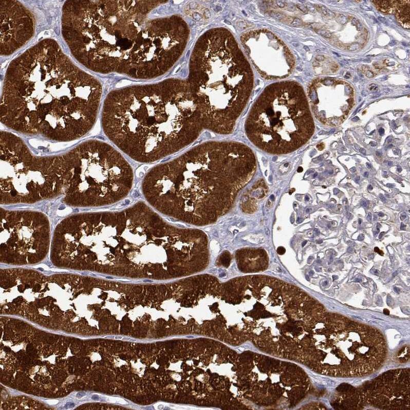 Dopa Decarboxylase/DDC Antibody - BSA Free Immunohistochemistry: Dopa Decarboxylase/DDC Antibody - BSA Free [NBP1-90293]