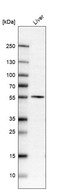 Dopa Decarboxylase/DDC Antibody - BSA Free Western Blot: Dopa Decarboxylase/DDC Antibody - BSA Free [NBP1-90293]