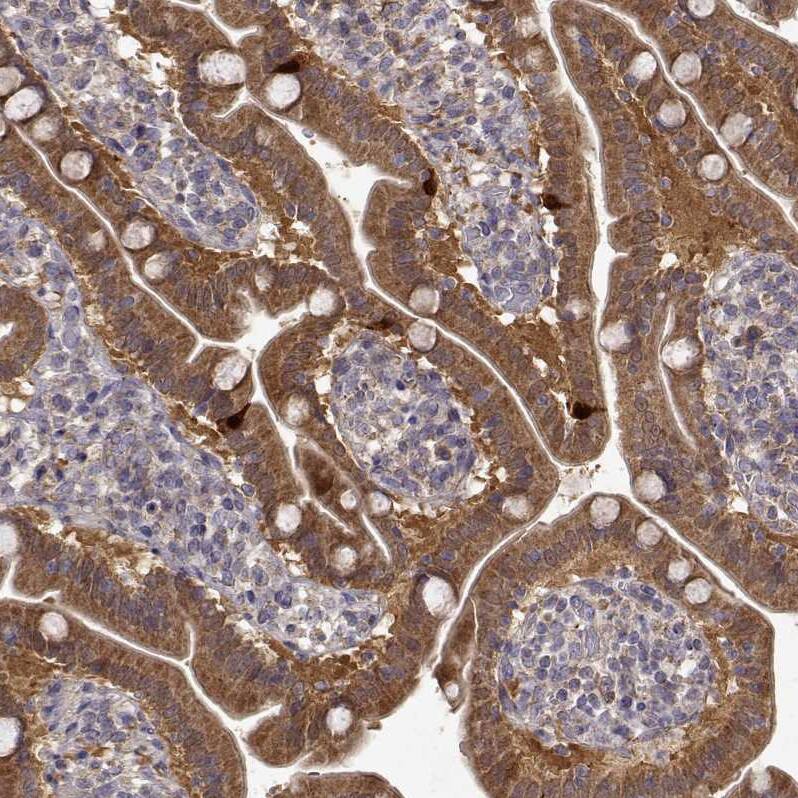Dopa Decarboxylase/DDC Antibody - BSA Free Immunohistochemistry: Dopa Decarboxylase/DDC Antibody - BSA Free [NBP1-90293]