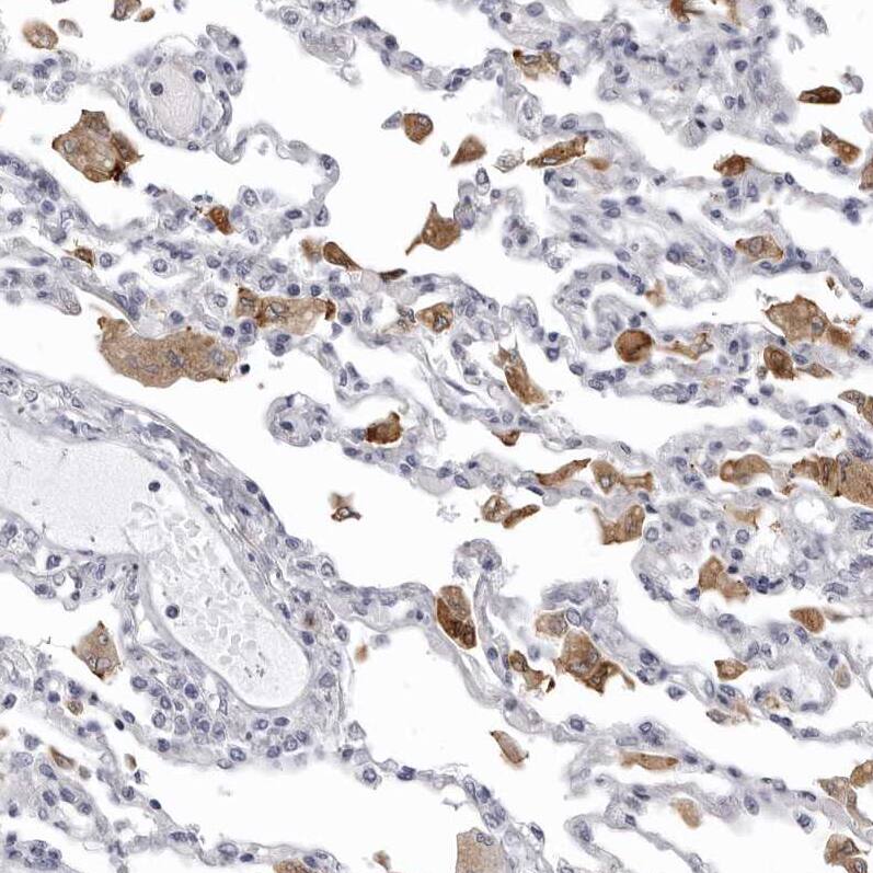 AADACL1 Antibody - BSA Free Immunohistochemistry: AADACL1 Antibody - BSA Free [NBP1-90294]