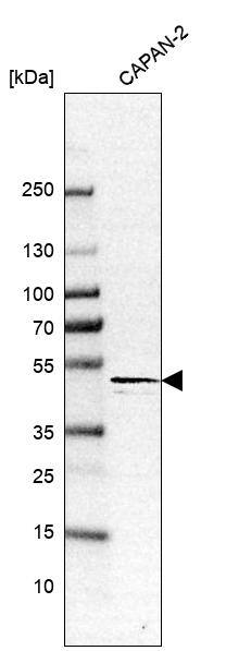 AADACL1 Antibody - BSA Free Western Blot: AADACL1 Antibody - BSA Free [NBP1-90294]