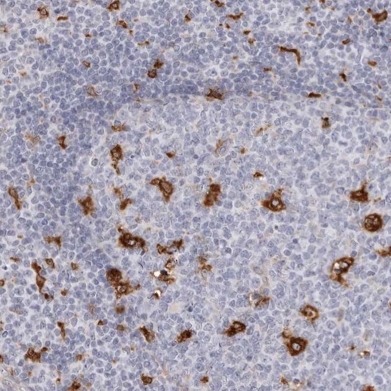 AADACL1 Antibody - BSA Free Immunohistochemistry: AADACL1 Antibody - BSA Free [NBP1-90294]