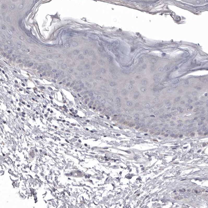 AADACL1 Antibody - BSA Free Immunohistochemistry: AADACL1 Antibody - BSA Free [NBP1-90294]