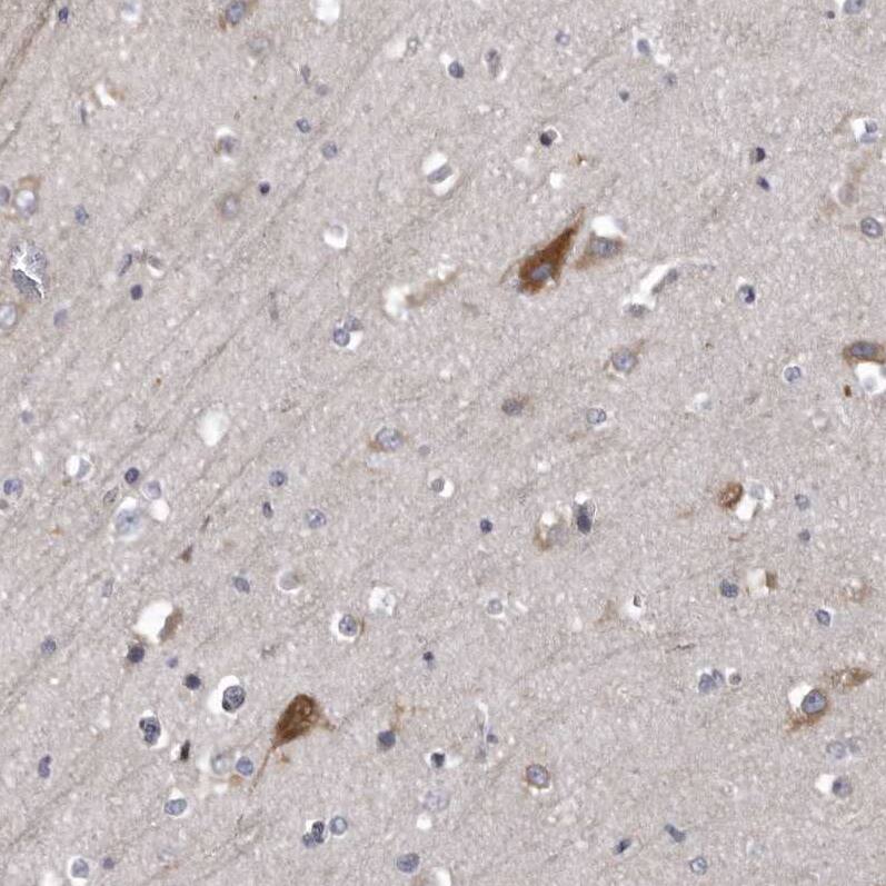 AADACL1 Antibody - BSA Free Immunohistochemistry: AADACL1 Antibody - BSA Free [NBP1-90294]