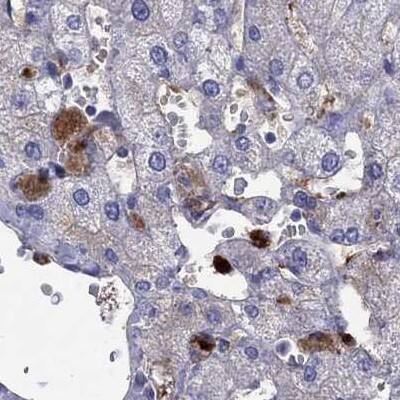 Serpin A3/alpha 1-Antichymotrypsin Antibody - BSA Free Immunohistochemistry: Serpin A3/alpha 1-Antichymotrypsin Antibody - BSA Free [NBP1-90296]