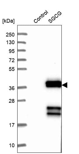 gamma Sarcoglycan Antibody - BSA Free Western Blot: gamma Sarcoglycan Antibody - BSA Free [NBP1-90299]