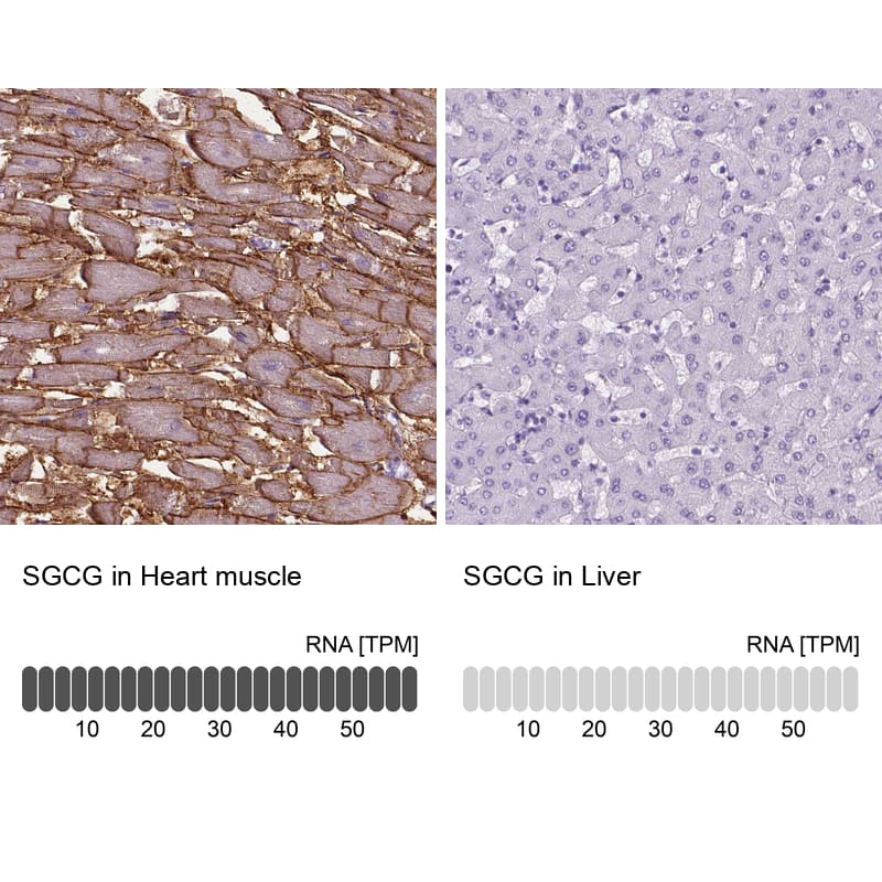 gamma Sarcoglycan Antibody - BSA Free Immunohistochemistry: gamma Sarcoglycan Antibody - BSA Free [NBP1-90299]