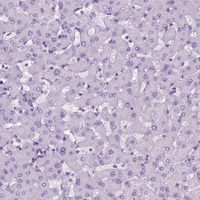 gamma Sarcoglycan Antibody - BSA Free Immunohistochemistry: gamma Sarcoglycan Antibody - BSA Free [NBP1-90299]