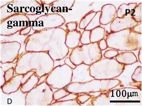 gamma Sarcoglycan Antibody - BSA Free