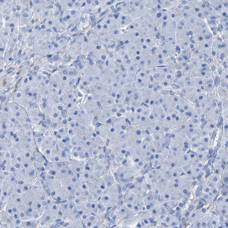 beta Sarcoglycan Antibody - BSA Free Immunohistochemistry: beta Sarcoglycan Antibody - BSA Free [NBP1-90300]