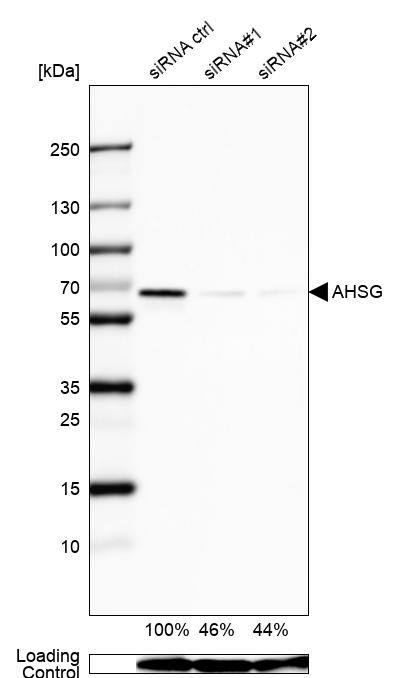 Fetuin A/AHSG Antibody - BSA Free Western Blot: Fetuin A/AHSG Antibody - BSA Free [NBP1-90302]