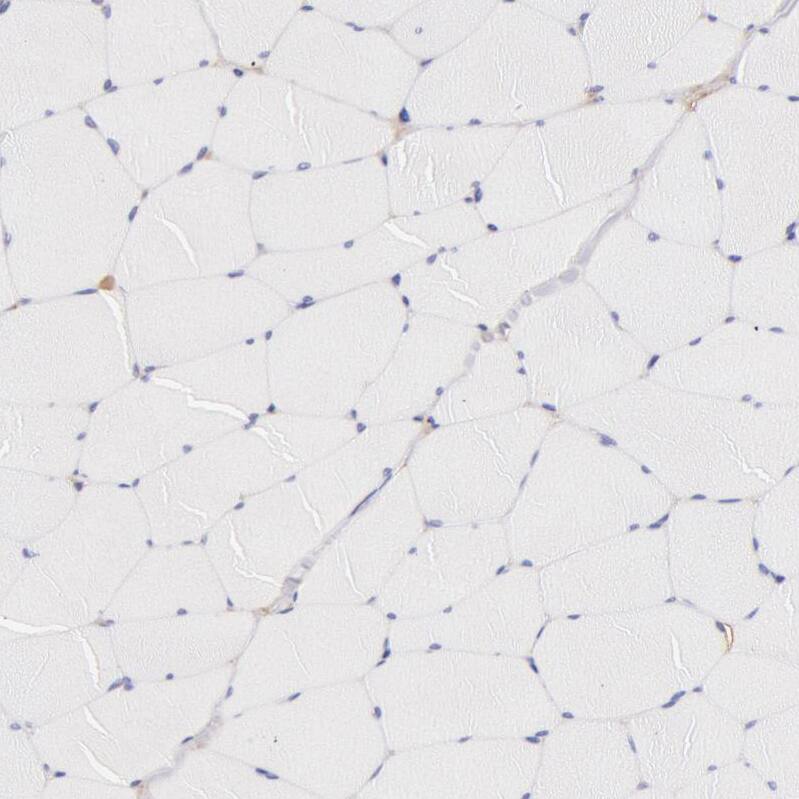 Fetuin A/AHSG Antibody - BSA Free Immunohistochemistry: Fetuin A/AHSG Antibody - BSA Free [NBP1-90302]