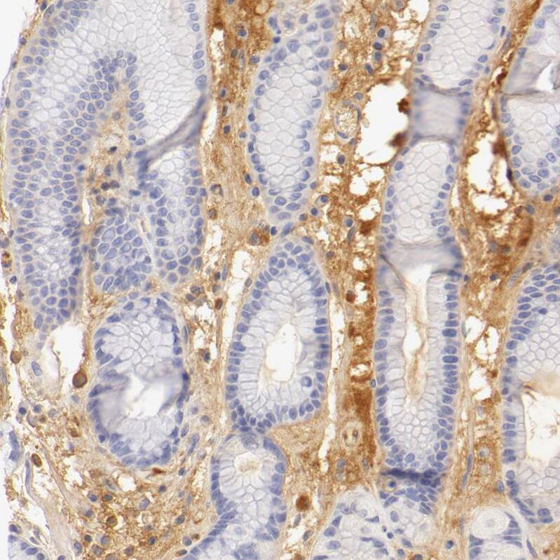 Fetuin A/AHSG Antibody - BSA Free Immunohistochemistry: Fetuin A/AHSG Antibody - BSA Free [NBP1-90302]