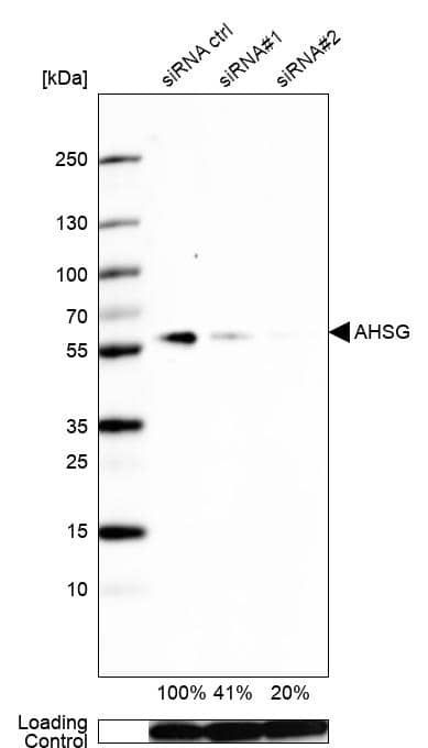 Fetuin A/AHSG Antibody - BSA Free Western Blot: Fetuin A/AHSG Antibody - BSA Free [NBP1-90303]