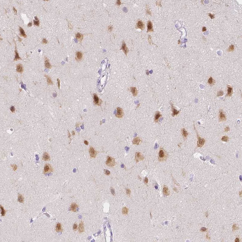 A2BP1 Antibody - BSA Free Immunohistochemistry: A2BP1 Antibody - BSA Free [NBP1-90304]