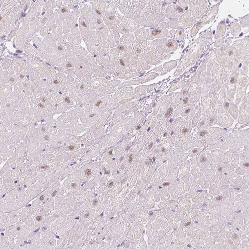 A2BP1 Antibody - BSA Free Immunohistochemistry: A2BP1 Antibody - BSA Free [NBP1-90304]