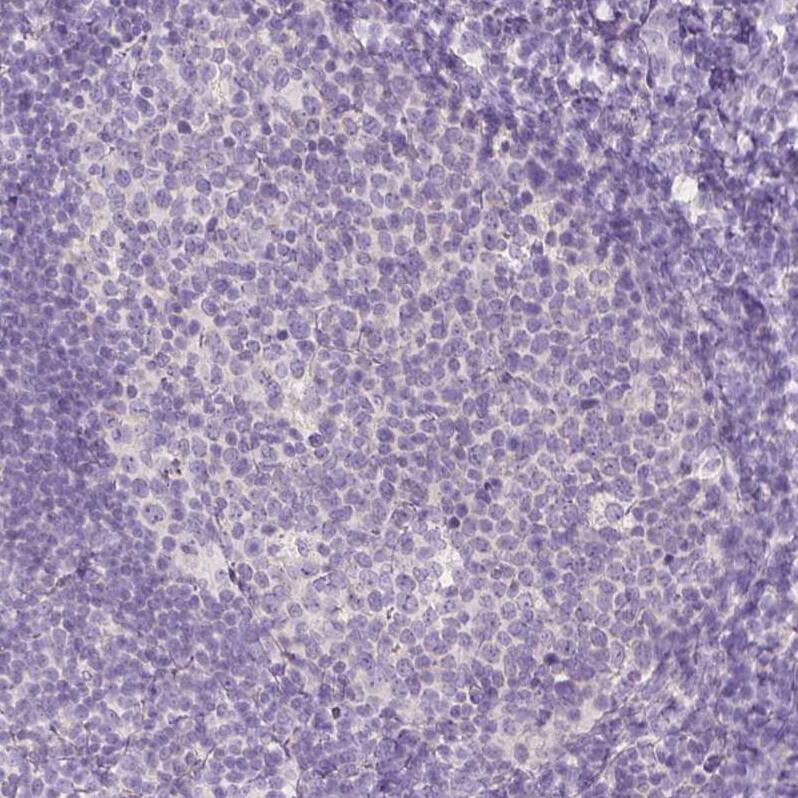 A2BP1 Antibody - BSA Free Immunohistochemistry: A2BP1 Antibody - BSA Free [NBP1-90304]