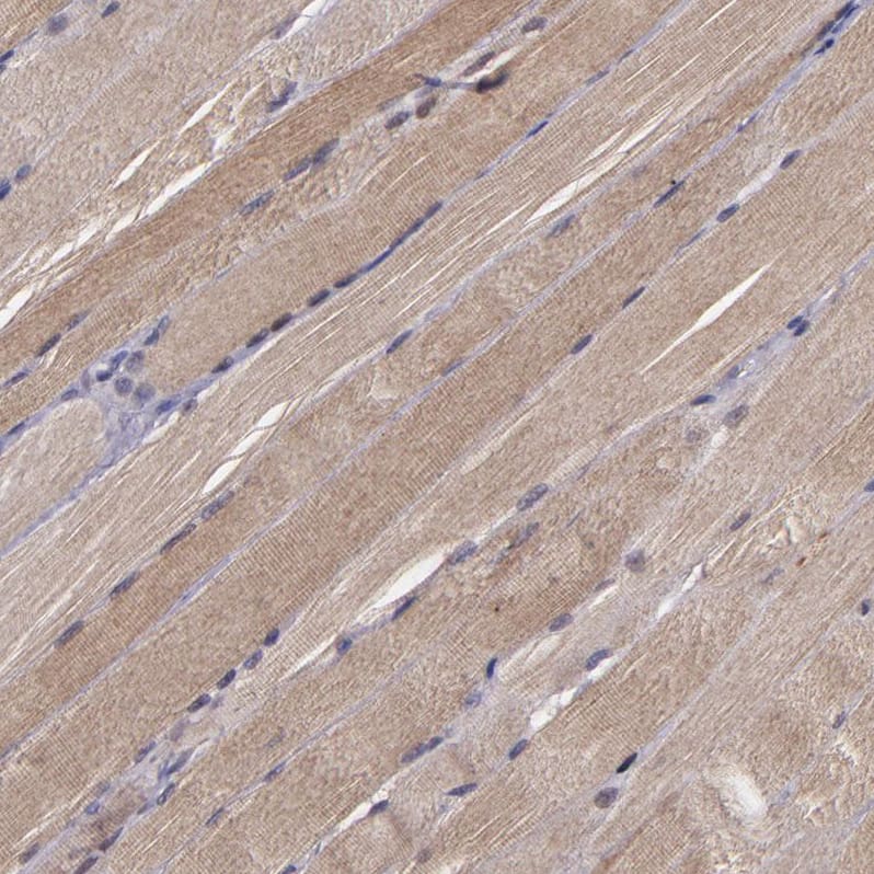Serpin F2/alpha 2-Antiplasmin Antibody - BSA Free Immunohistochemistry: Serpin F2/alpha 2-Antiplasmin Antibody - BSA Free [NBP1-90305]