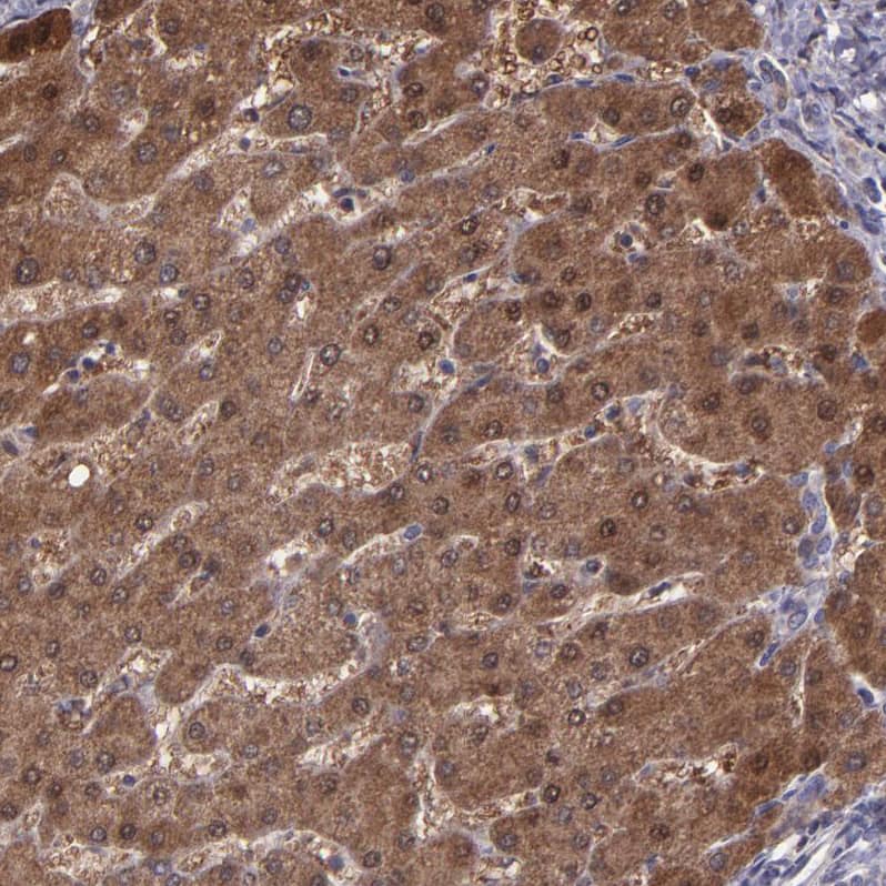 Serpin F2/alpha 2-Antiplasmin Antibody - BSA Free Immunohistochemistry: Serpin F2/alpha 2-Antiplasmin Antibody - BSA Free [NBP1-90305]