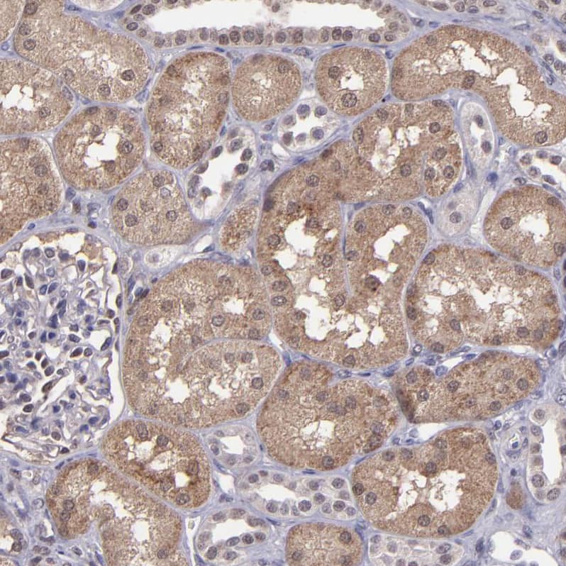 Serpin F2/alpha 2-Antiplasmin Antibody - BSA Free Immunohistochemistry: Serpin F2/alpha 2-Antiplasmin Antibody - BSA Free [NBP1-90305]