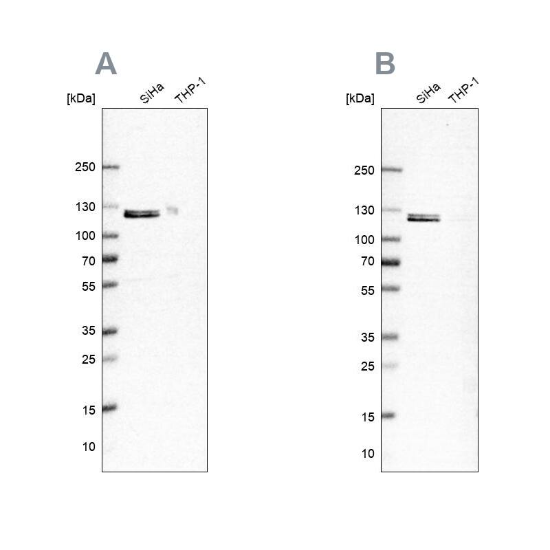 Ubiquitin-activating Enzyme/UBE1 Antibody - BSA Free Western Blot: Ubiquitin-activating Enzyme/UBE1 Antibody - BSA Free [NBP1-90307]